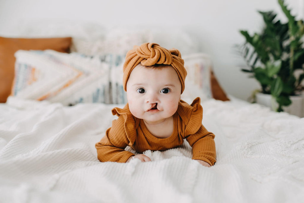 9 Tips for the First Year of Your Baby's Cleft Journey