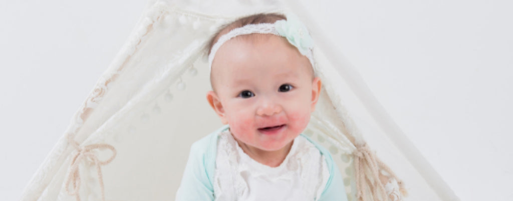 Little Warrior's Eczema Journey