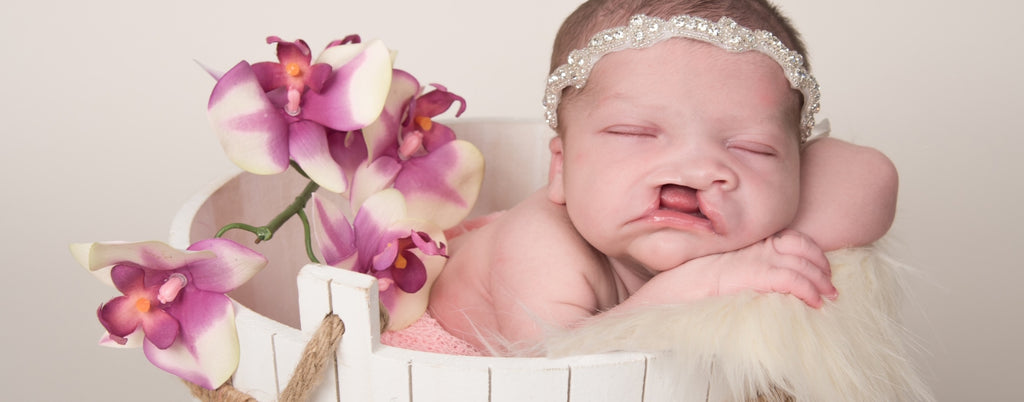 A Mama Coach for Baby Cleft Journeys