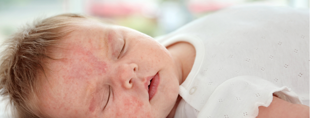 10 Strategic Steps to Pinpoint the Underlying Cause(s) of Baby Skin Irritations